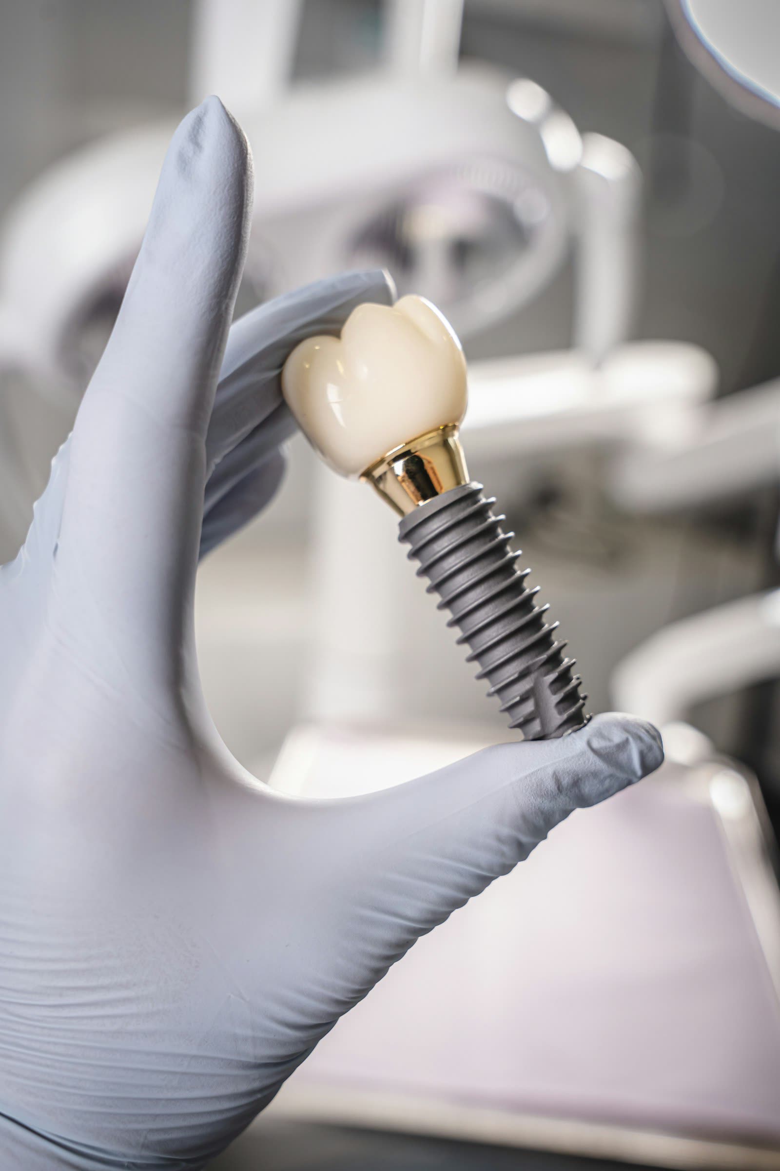 Couronne céramique sur implant